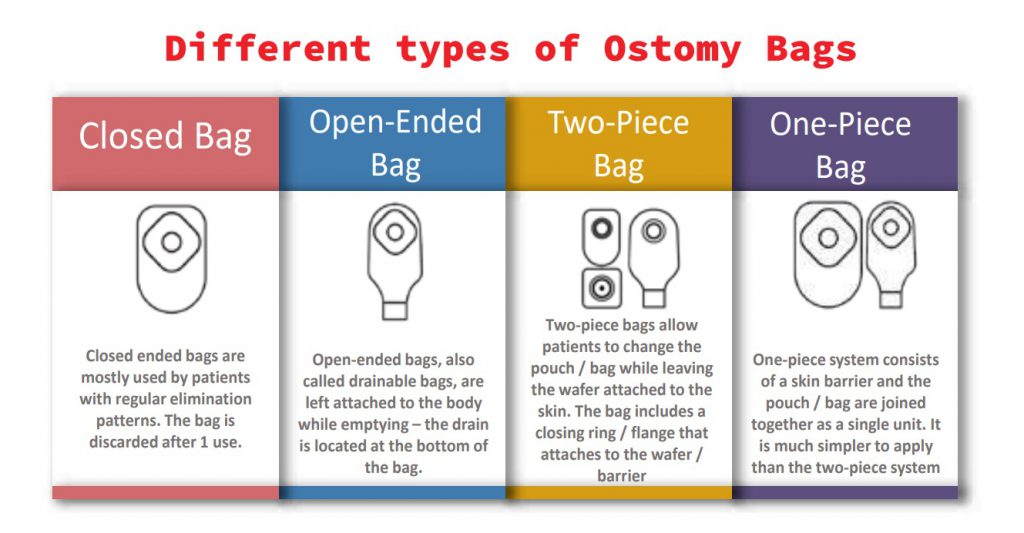 What is a colostomy bag, and what is used for?